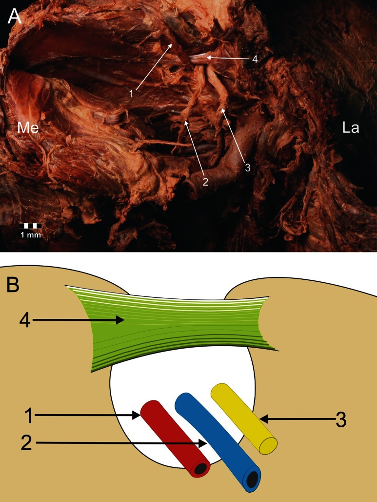 Fig. 4