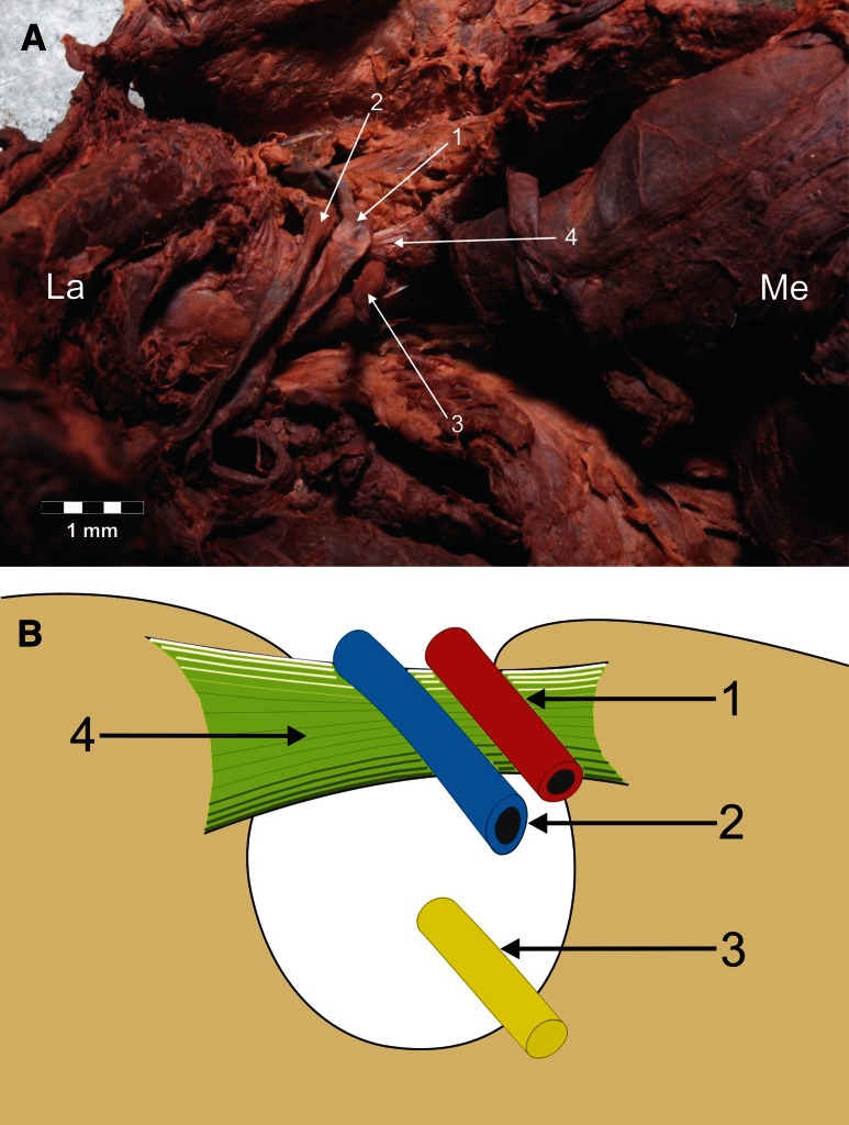 Fig. 3