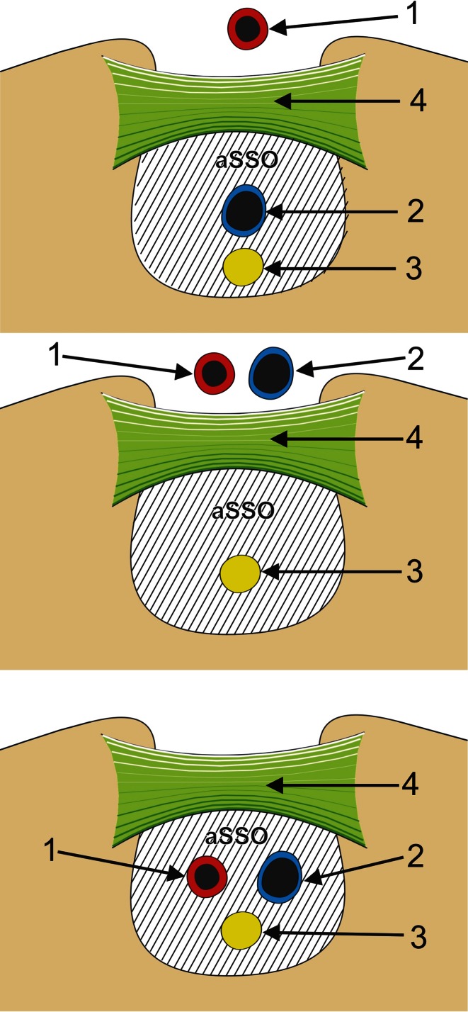 Fig. 1