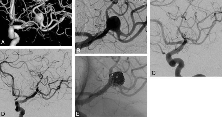 Fig 2.