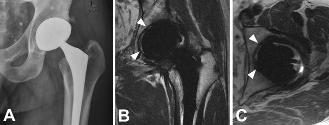 Fig. 4 A-C