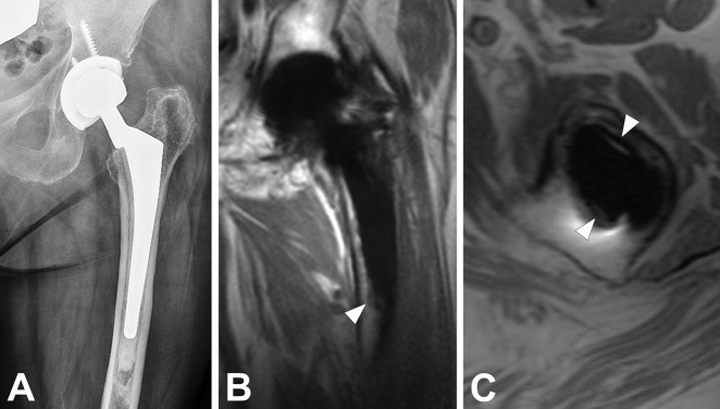 Fig. 6 A-C