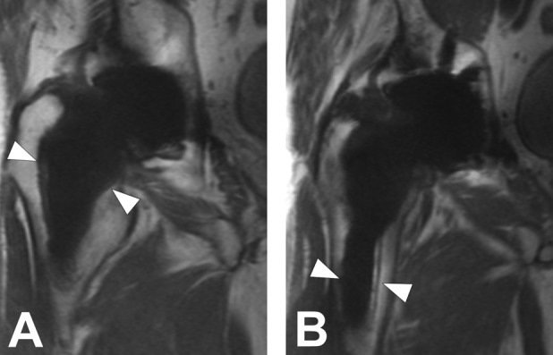 Fig. 3 A-B