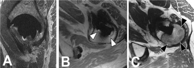 Fig. 2 A-C