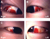 Fig. (1)