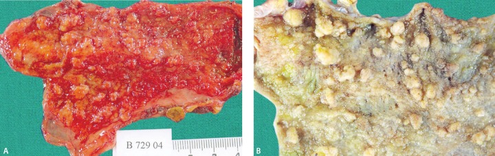 Figs 2A and B