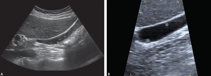 Fig. 6A and B