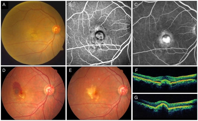 Fig. 3