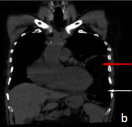 [Table/Fig-1b]: