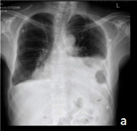 [Table/Fig-1a]: