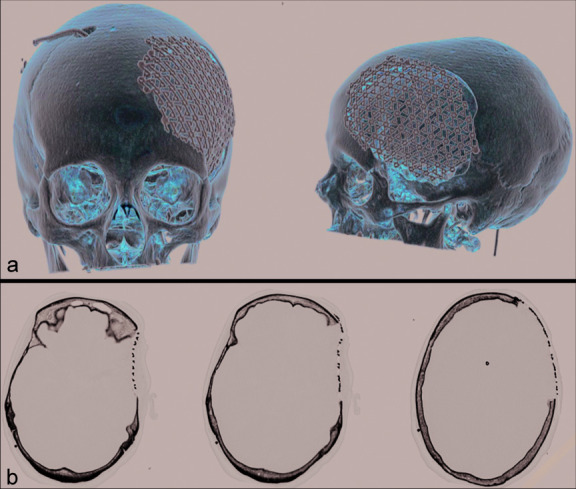 Figure 4: