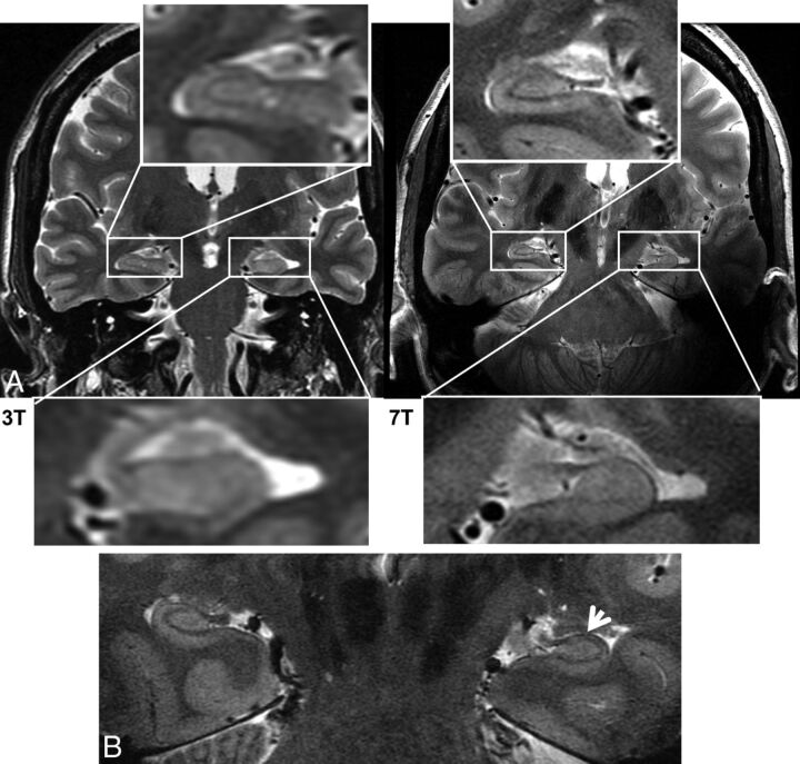 Fig 7.