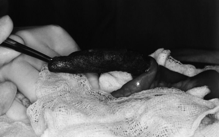 Fig 6.