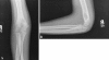 Fig. 1A–B
