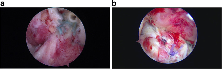 Fig. 13