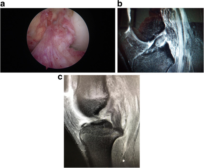 Fig. 12