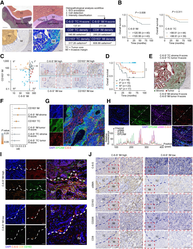 Figure 3. An “exclusion barrier” was constructed by C-6-S and M2 macrophages in MSS CRC invasive margin. A, Schematic of digital pathology analysis. Left: i, Manual delineation of TC and IM. ii, Enlarged images of TC and IM region. iii-iv, Region delineation (iii) and digital identification of cell structure and stain intensity (iv). Right: Example of digital pathology analysis workflow and output. Scale bar: 2 mm in (i), 500 μm in (ii) and 200 μm for (iii) and (iv). B, Kaplan–Meier plots for the 5-year survival of MSS colorectal cancer in C-6-S+IM or C-6-S+TC low/high subgroups. The survminer R package determined the optimal cutoffs. P value was determined by log-rank test. C and D, Left, patients were grouped by C-6-S+ IM and CD163+ IM optimal cutoffs for OS. Right, representative IHC images of group I* and III* (C). Scale bar: 100μm. Overall survival (D) of four subgroups is shown. P value was determined by Log-rank test. E and F, Recognition of tumor and stroma cells using QuPath software and the H-score of C-6-S+ stroma and C-6-S+ tumor in IM and TC (E). Scale bar: 200 μm. Univariate Cox regression analysis for 5-year OS (F). The HR and 95% confidence intervals are shown. IF detected EPCAM and C-6-S (G) or EPCAM, αSMA and C-6-S (H) in human colorectal cancer specimens. Nuclei are shown in blue (DAPI). EPCAM (tumor cell marker) is in green, αSMA (CAF marker) is in purple and C-6-S is in red. The fluorescent intensity at each position along the indicated diagonal were quantified (H, bottom left). Scale bar: 50 μm. I, IF assay with C-6-S (red), CD8 (orange), and CD163 (green) in IM and TC regions. White circles highlight the adjacent position of CD8+ T cells (CD8) and M2 macrophages (CD163). Scale bar: 50 μm. J, Representative IHC images displaying the differential expression of C-6-S, αSMA, CD163, CD206 and CD8 in C-6-S+ IM stroma, stratified by H-score high/low groups. Scale bar: 100 μm. ***, P < 0.001.