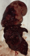 Fig 3 –