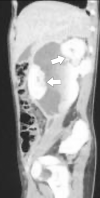 Fig 4 –