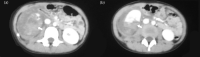 Fig 1 –