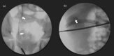 Fig 5 –