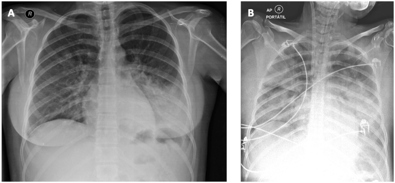 Fig. 1