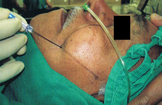 Fig. 8