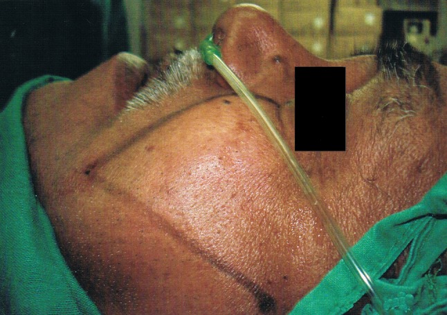 Fig. 7