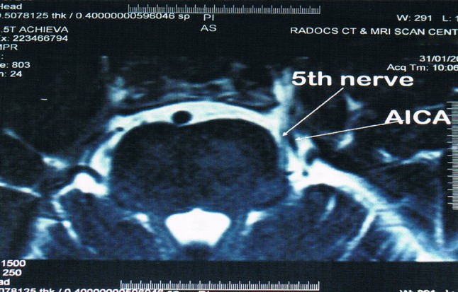 Fig. 3