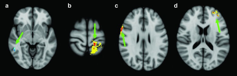 FIG. 3.