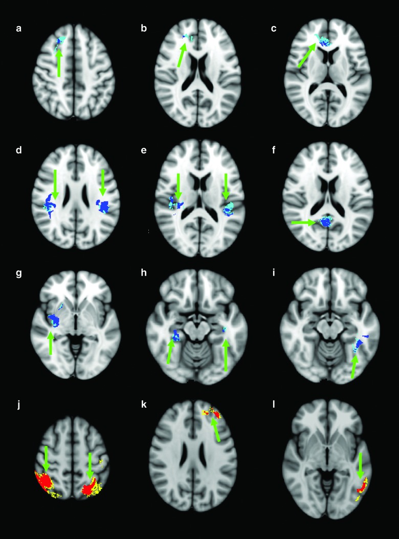 FIG. 1.