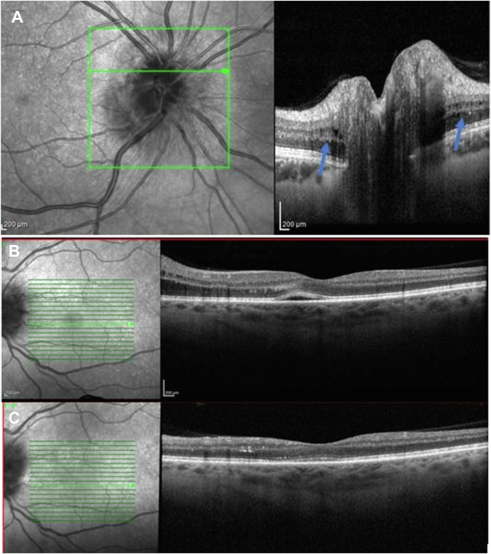 Figure 1