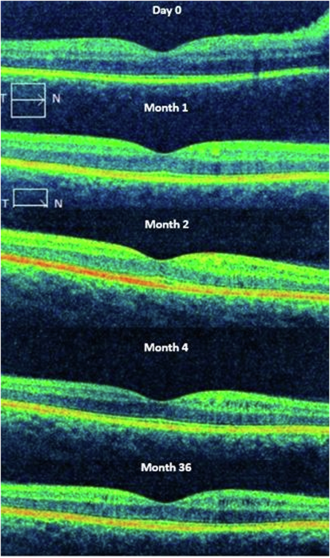 Figure 4