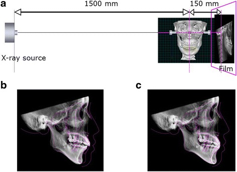 Fig. 17