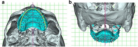 Fig. 11