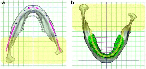 Fig. 10