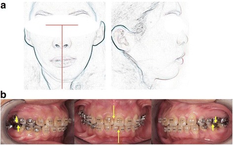 Fig. 14