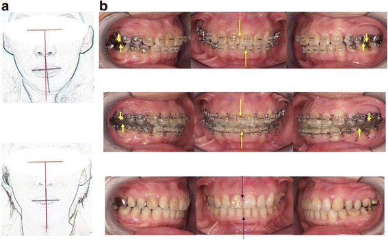 Fig. 18