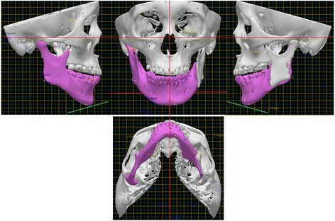 Fig. 16