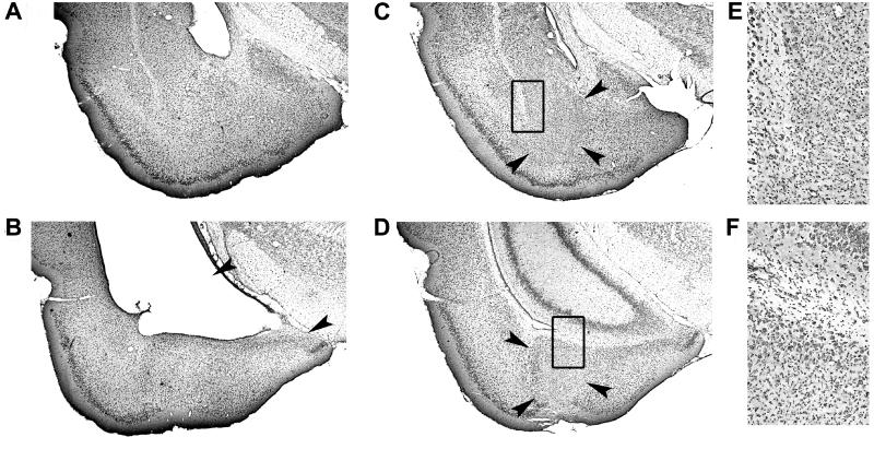 Fig 4.