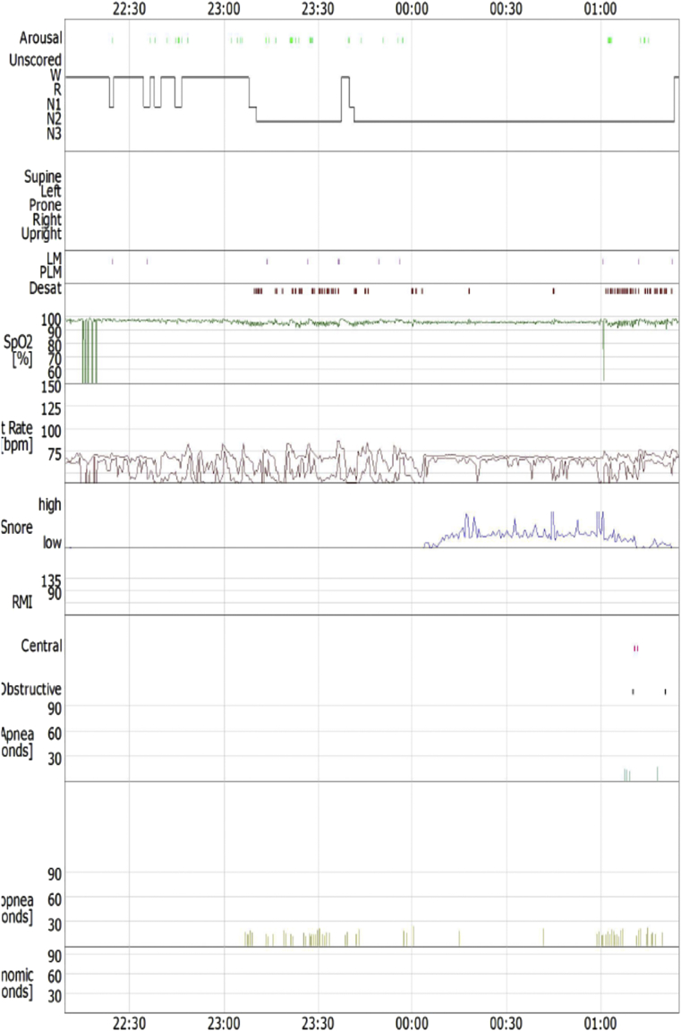 Fig. 2