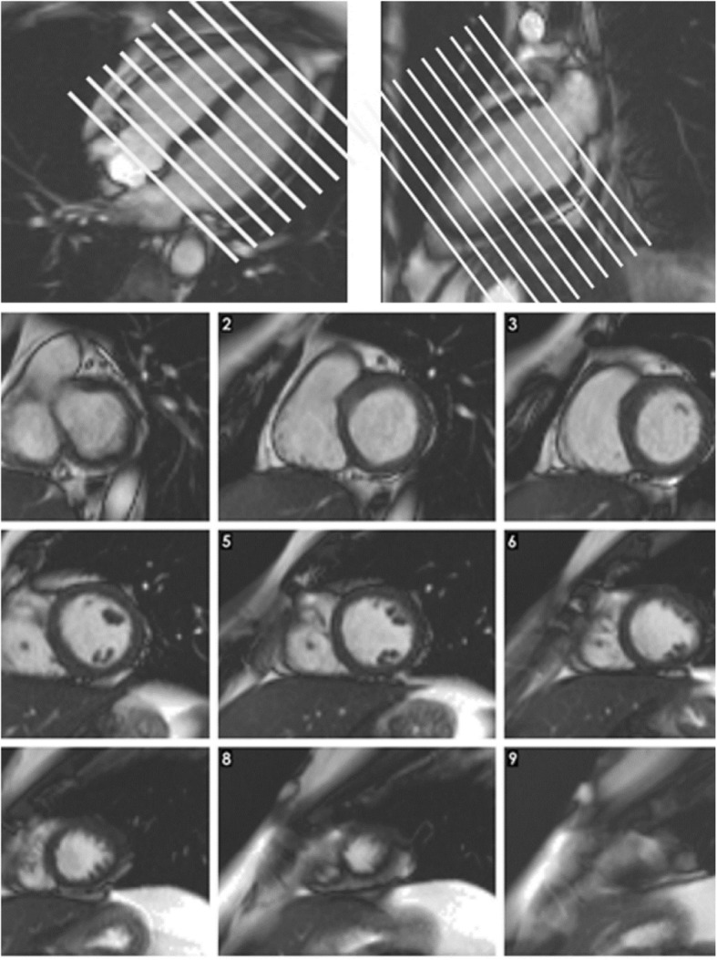 Fig. 2