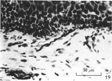 Fig. 19