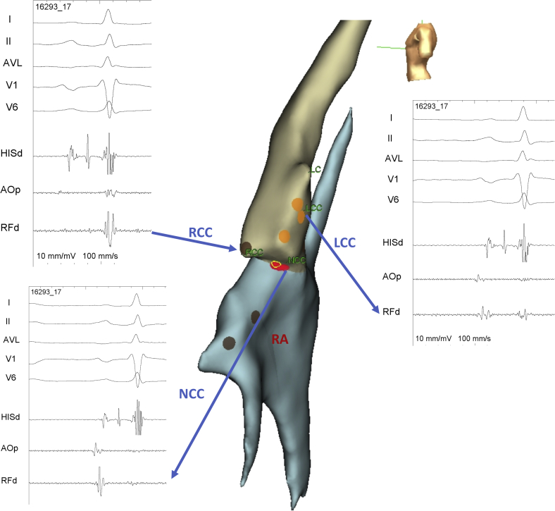 Figure 2