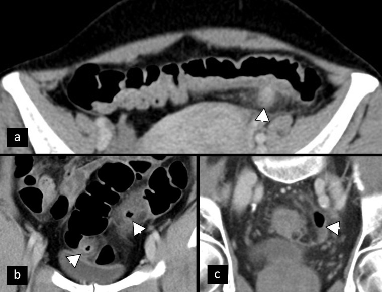 Figure 15.