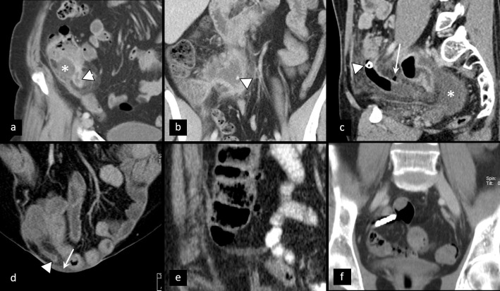 Figure 14.