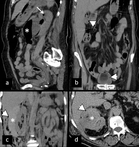 Figure 13.