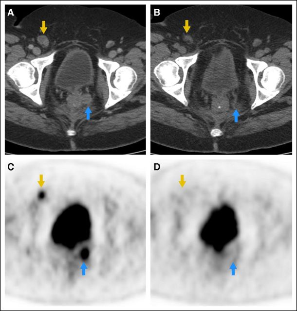 Fig 2.