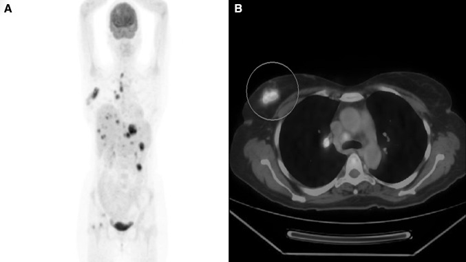 Fig. 2