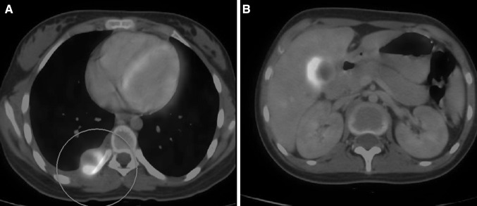 Fig. 1